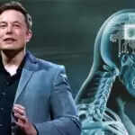 Neuralink Blindsight: एलन मस्क की कंपनी ने विकसित किया ब्रेन इम्प्लांट