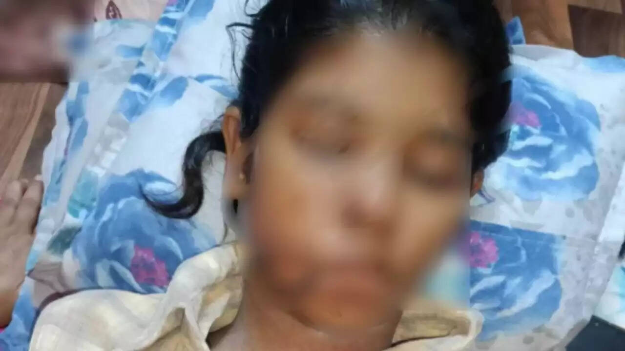 कानपुर में छात्रा पर आवारा कुत्तों का हमला, गंभीर चोटें आईं