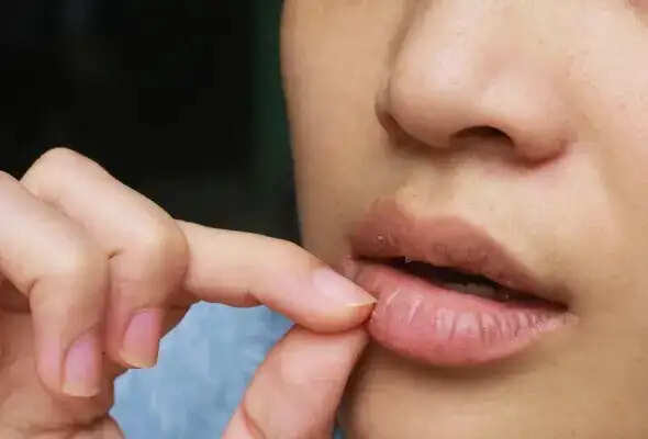 मुंह के छालों से राहत पाने के लिए अमरूद का सेवन करें