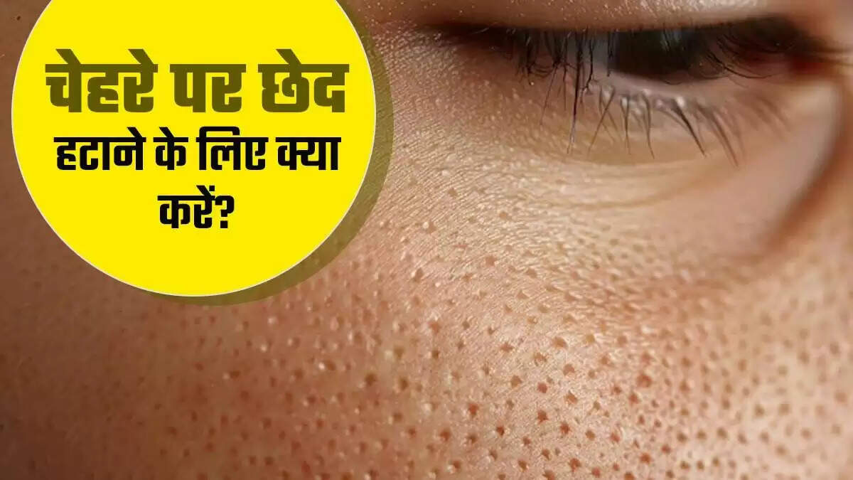 खुले रोमछिद्रों से राहत पाने के लिए प्रभावी घरेलू नुस्खे