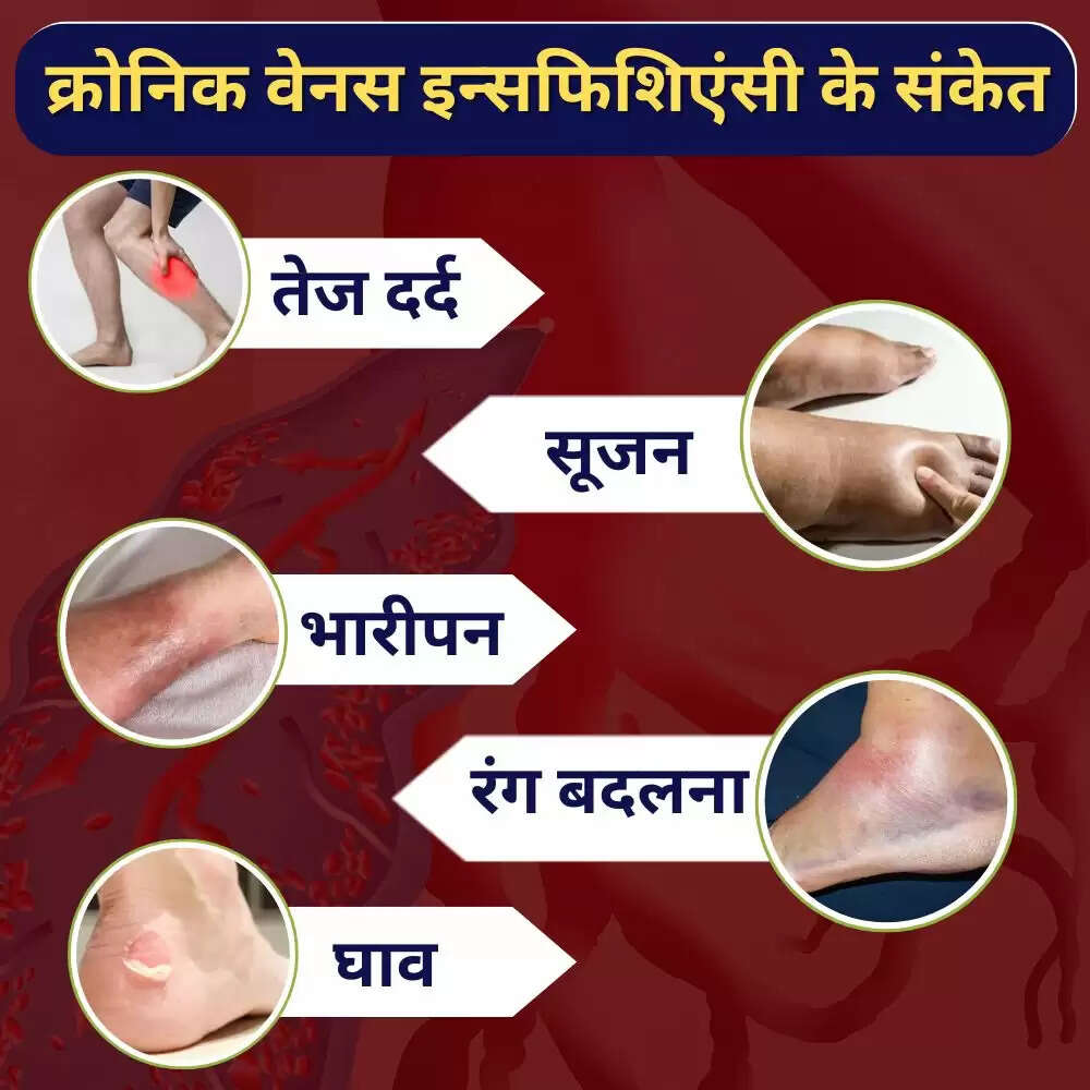 डोनाल्ड ट्रंप की बीमारी: जानें CVI के लक्षण और उपचार