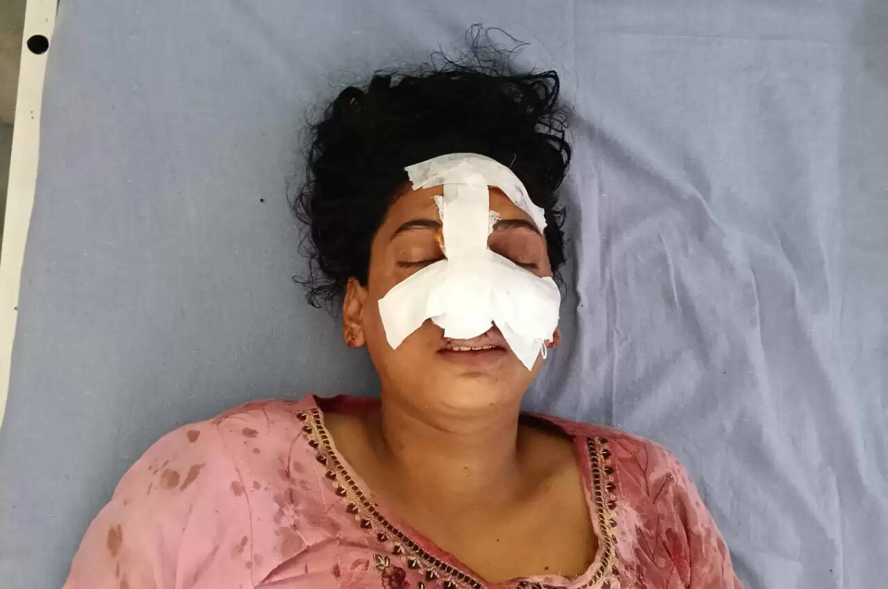 पति ने तलाक के बाद पत्नी की नाक काटी, गंभीर हालत में अस्पताल में भर्ती