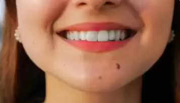 गालों पर तिल: सामुद्रिक शास्त्र के अनुसार सौभाग्य और आकर्षण का प्रतीक