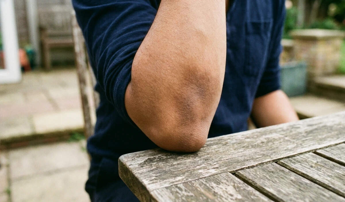 गर्दन, कोहनी और घुटनों के कालापन को दूर करने के घरेलू उपाय