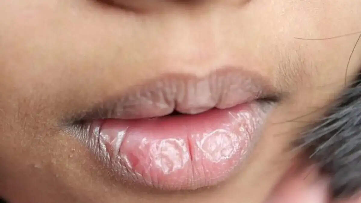 खूबसूरत और गुलाबी होठों के लिए प्रभावी उपाय