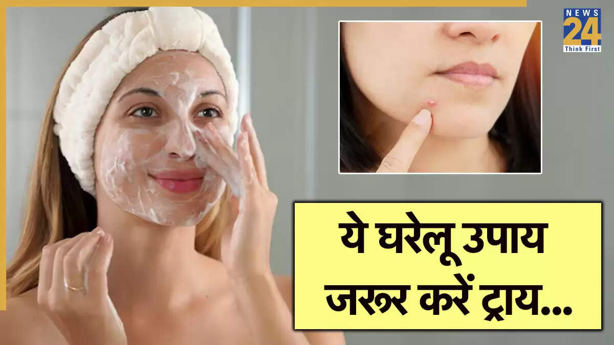 त्वचा की देखभाल: पिंपल और मुहासों से छुटकारा पाने के प्राकृतिक उपाय