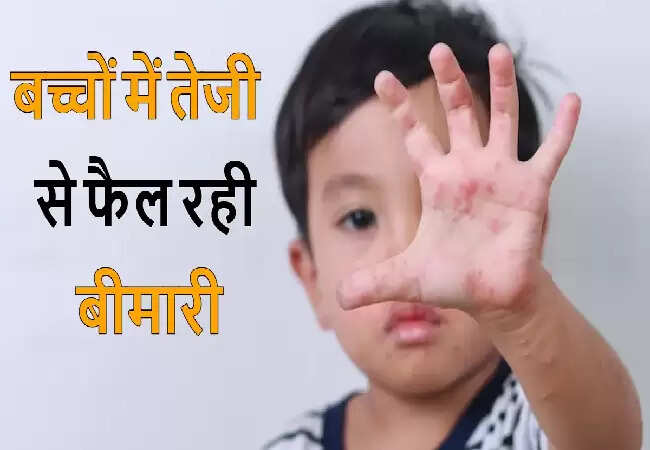 हाथ, पैर और मुंह रोग: लक्षण और बचाव के उपाय