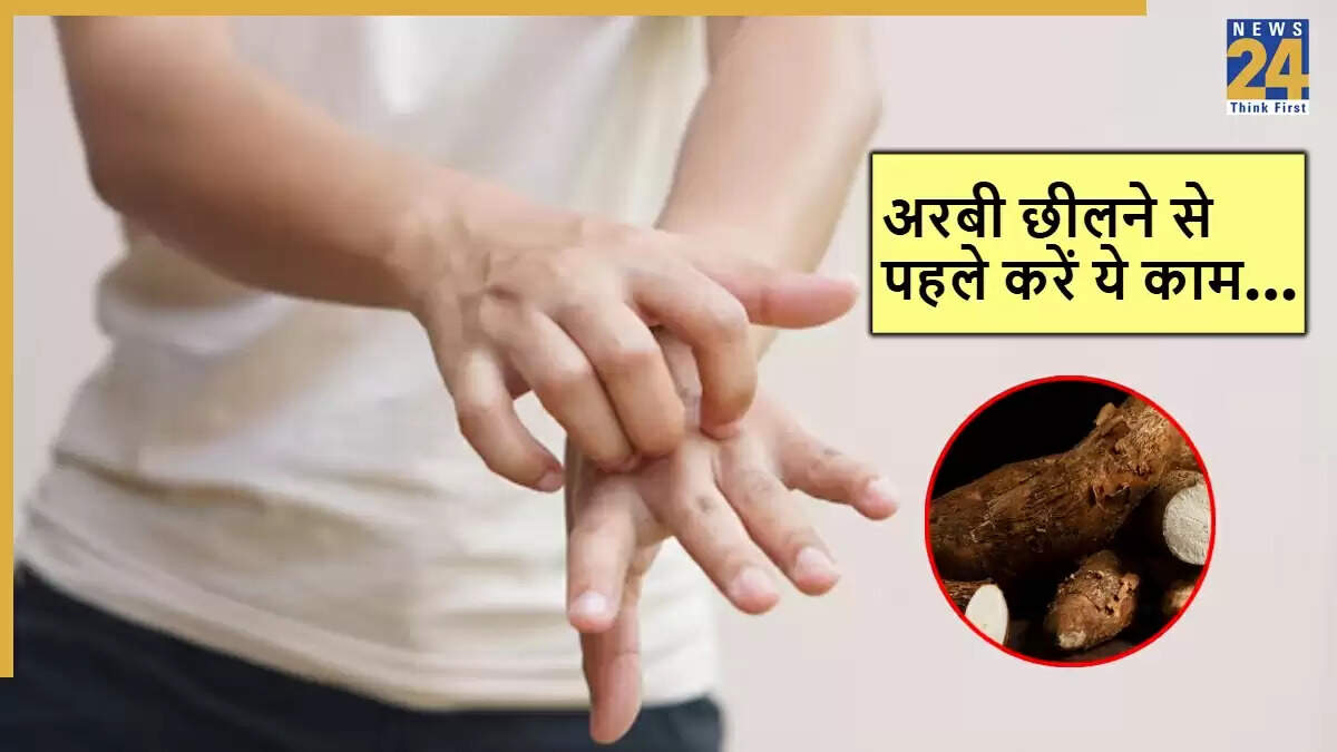 अरबी छीलने के लिए 5 सरल उपाय: जलन और खुजली से बचें