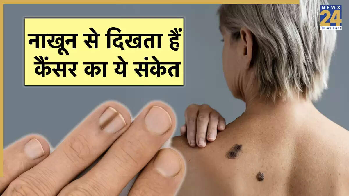 नकली नाखूनों से कैंसर का खतरा: जानें लक्षण और बचाव के उपाय