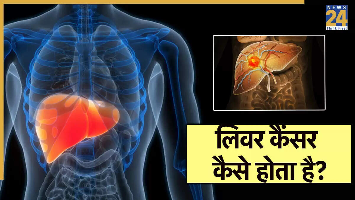 लिवर कैंसर के लक्षण और बचाव के उपाय