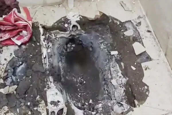 छिंदवाड़ा अस्पताल में नवजात का शव टॉयलेट में फंसा मिला, 8 घंटे की मेहनत से निकाला गया