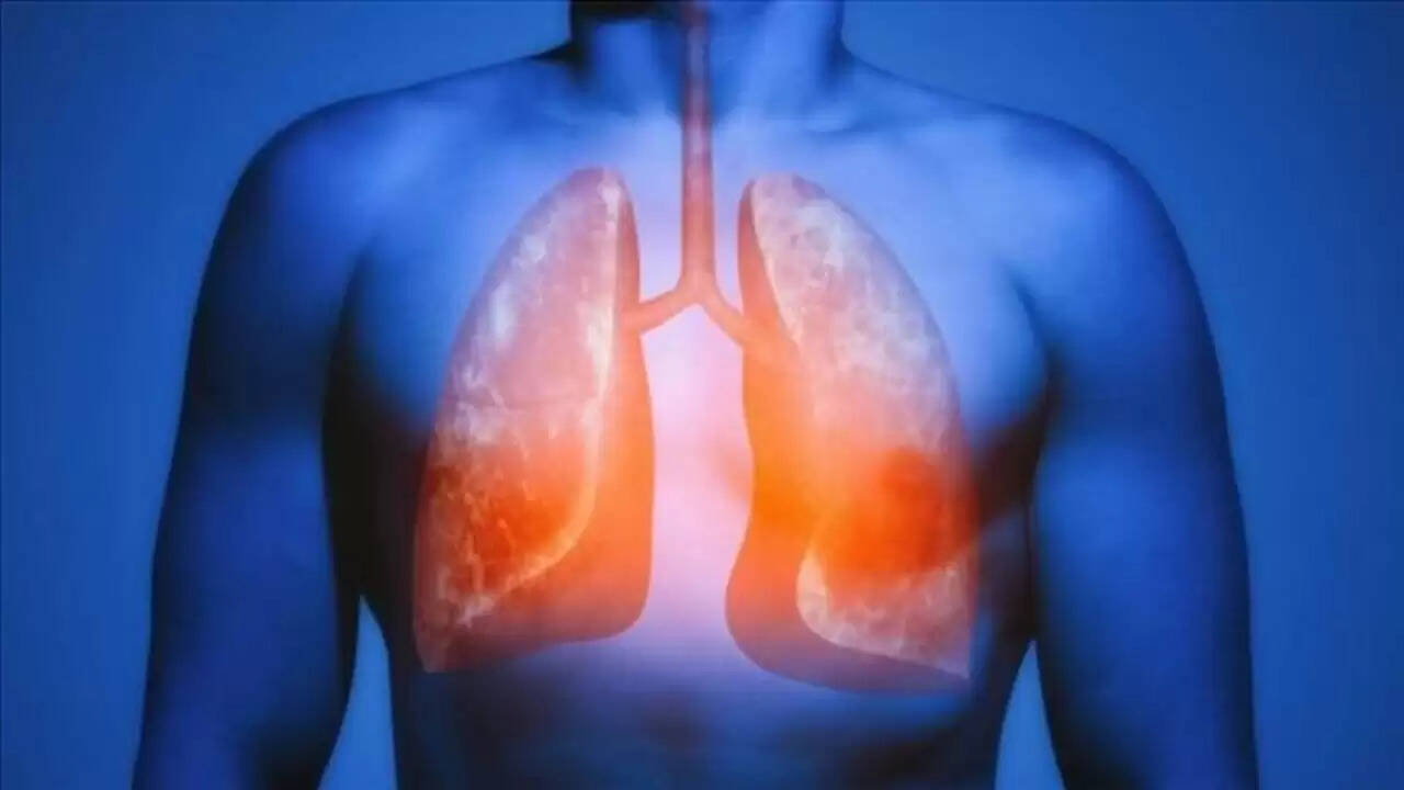 फेफड़ों की सेहत को सुधारने के उपाय और सावधानियाँ