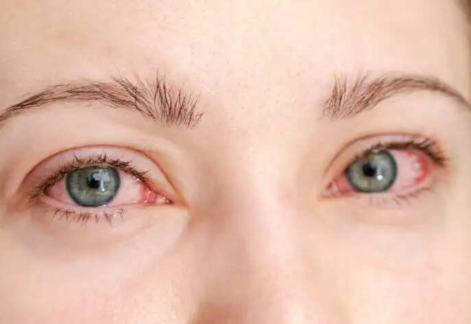 बदलते मौसम में आंखों की सुरक्षा के उपाय