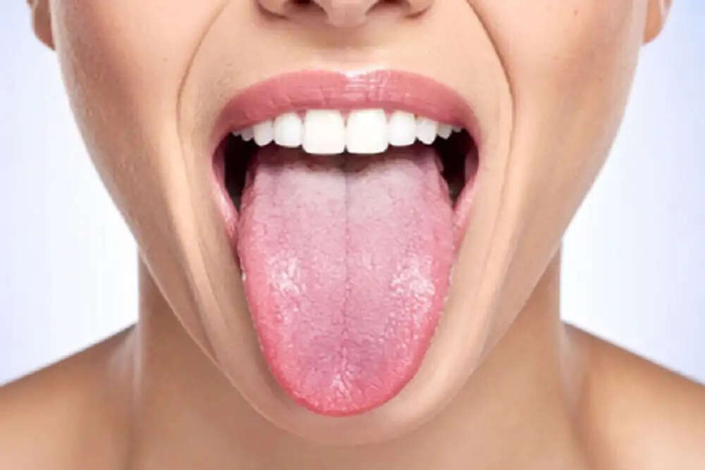 आयुर्वेद के अनुसार जीभ के रंग से जानें स्वास्थ्य की स्थिति