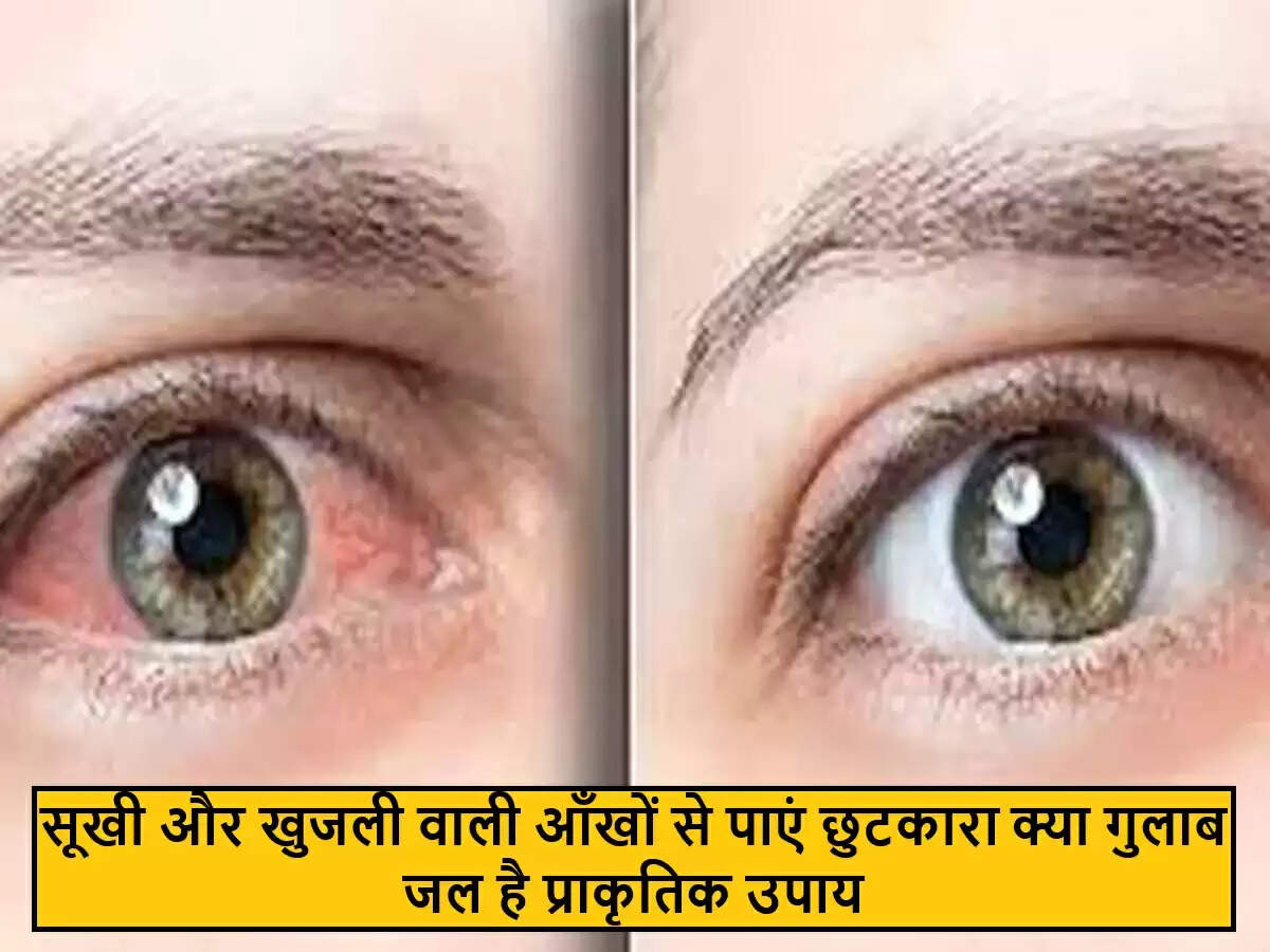 गुलाब जल: सूखी आँखों के लिए एक प्राकृतिक उपाय