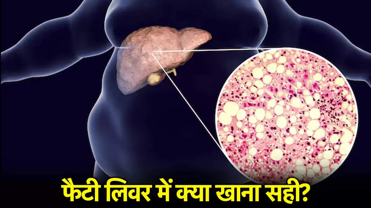 फैटी लिवर बीमारी: जानें कौन से खाद्य पदार्थ हैं फायदेमंद