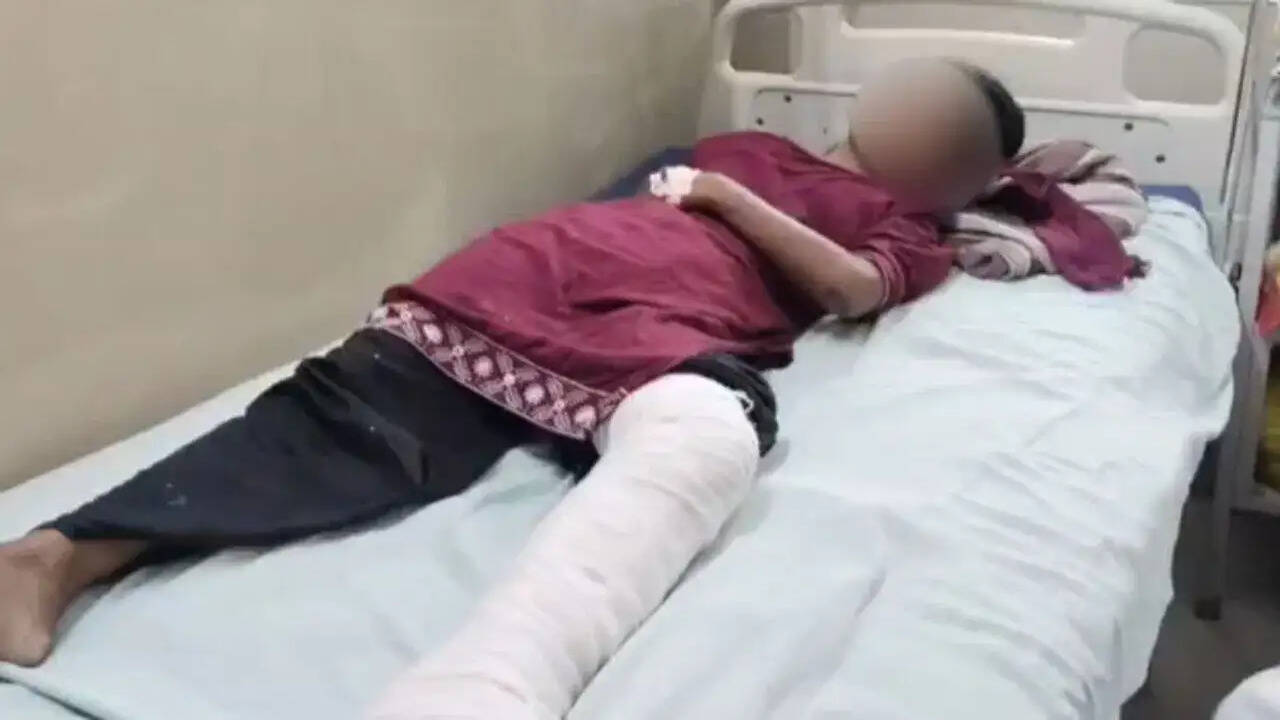 बरेली में दहेज के लिए महिला पर हमला, पति और ससुरालवालों पर मामला दर्ज