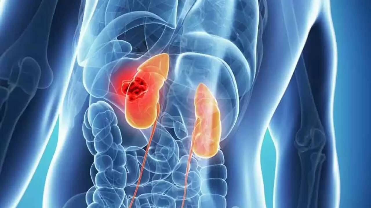 किडनी स्वास्थ्य: प्रारंभिक लक्षण जो आपको सतर्क कर सकते हैं