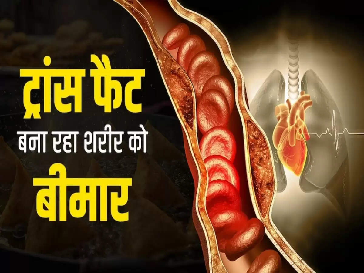 ट्रांस फैट का स्वास्थ्य पर प्रभाव: जानें कैसे बचें