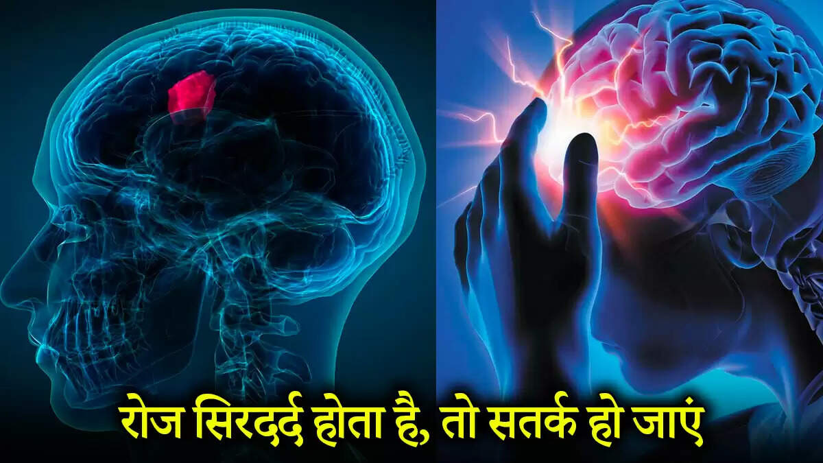 ब्रेन ट्यूमर डे 2025: सिरदर्द के संकेत और सावधानियाँ