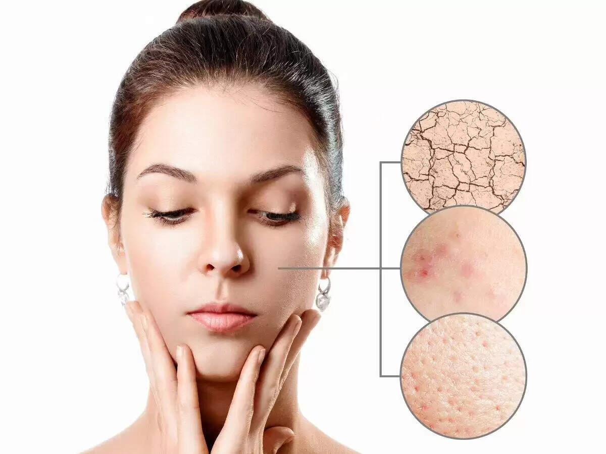 सर्दियों में त्वचा की देखभाल: विटामिनों की भूमिका और उपाय