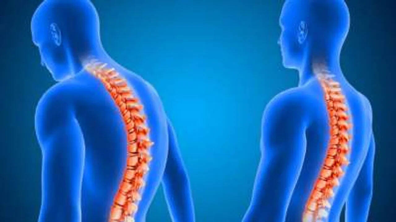कमर दर्द की समस्या: जेनरेशन Z में बढ़ती चिंता