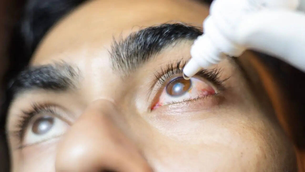 आई ड्रॉप्स के दुष्प्रभाव: आंखों की सुरक्षा के लिए जानें जरूरी बातें