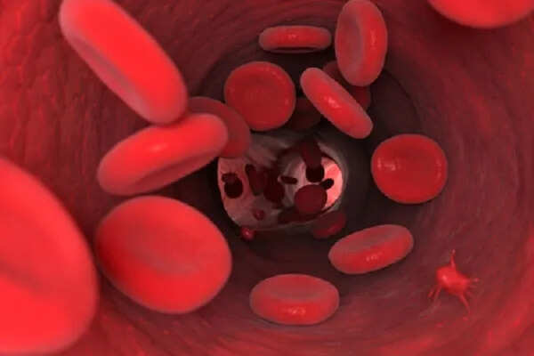 गर्भावस्था में हीमोग्लोबिन की कमी: मां और बच्चे के लिए खतरा