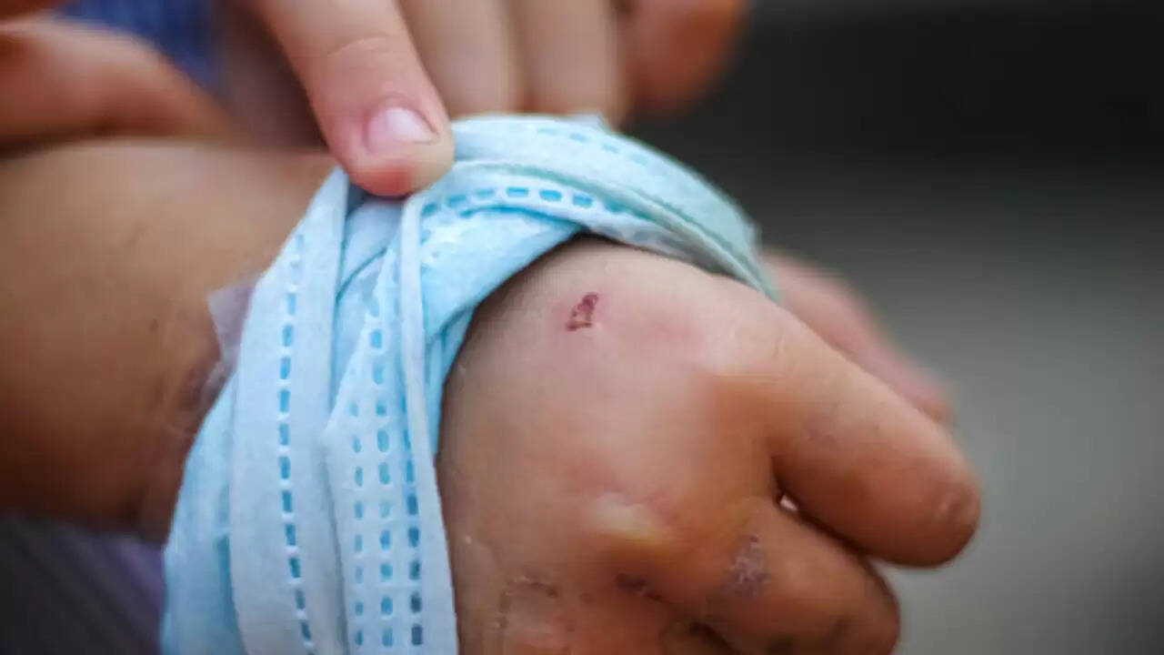 पटाखों के शोर से कुत्ते का हमला, 9 महीने के बच्चे की मौत