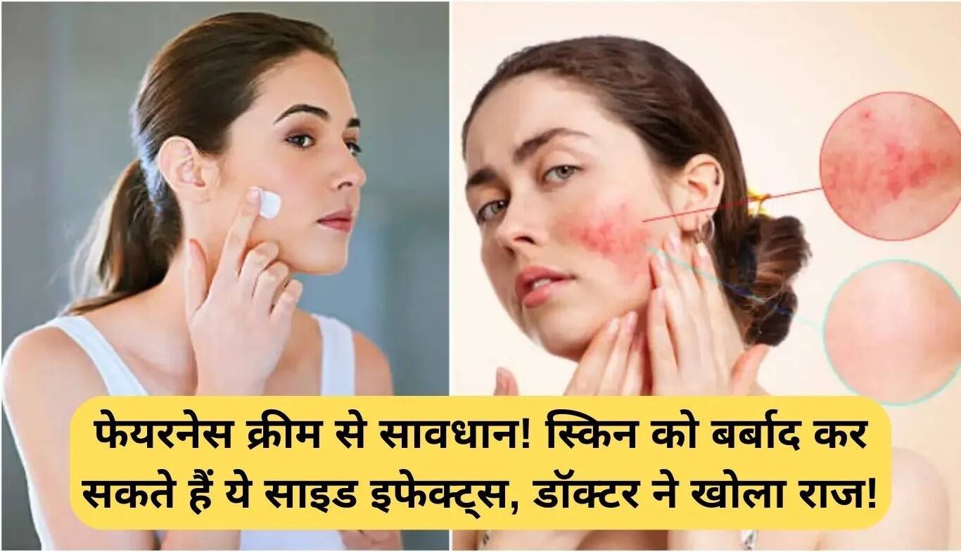 फेयरनेस क्रीम के दुष्प्रभाव: जानें क्यों हैं ये हानिकारक