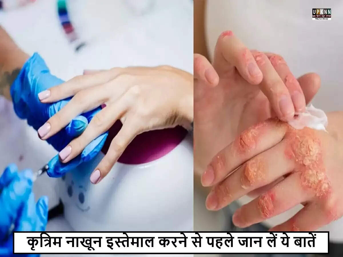 कृत्रिम नाखून और सोरायसिस: क्या है संबंध?
