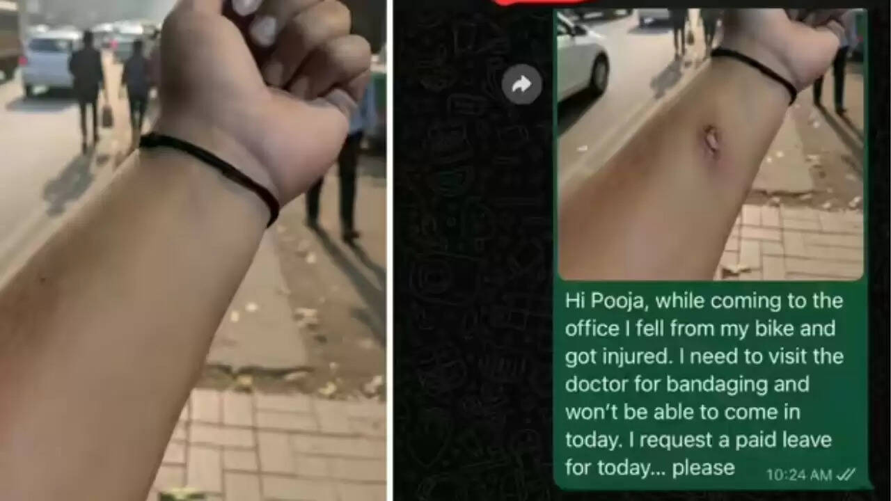 AI की मदद से बनाई गई नकली चोट: क्या है इसके पीछे का सच?