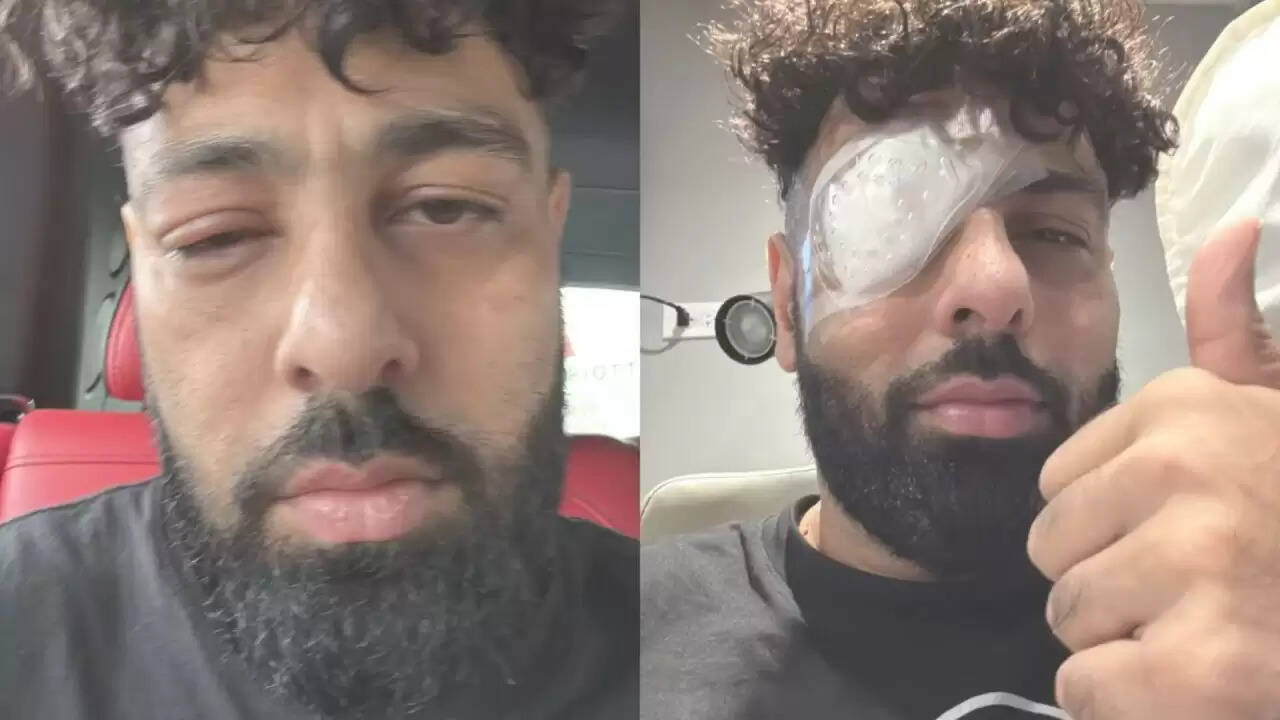 Badshah की आंख में चोट: क्या है इस रैपर की स्थिति?