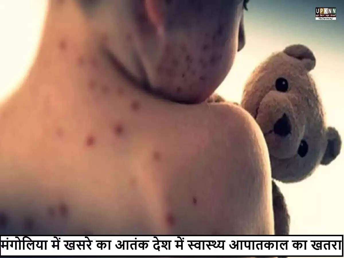 मंगोलिया में खसरे का प्रकोप: स्वास्थ्य संकट और टीकाकरण की आवश्यकता