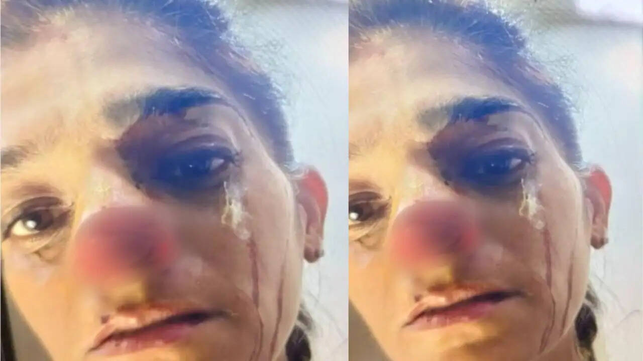 गोवर्धन में श्रद्धालु युवती पर हमला: क्या है पूरा मामला?