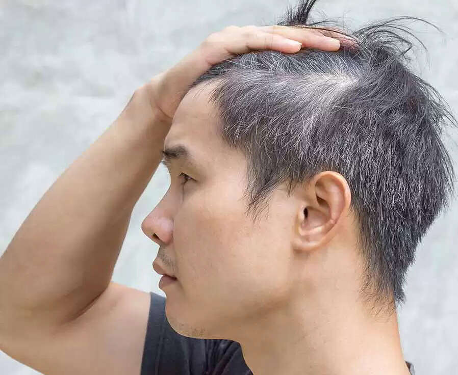 बालों के झड़ने से राहत पाने के लिए प्रभावी घरेलू उपाय