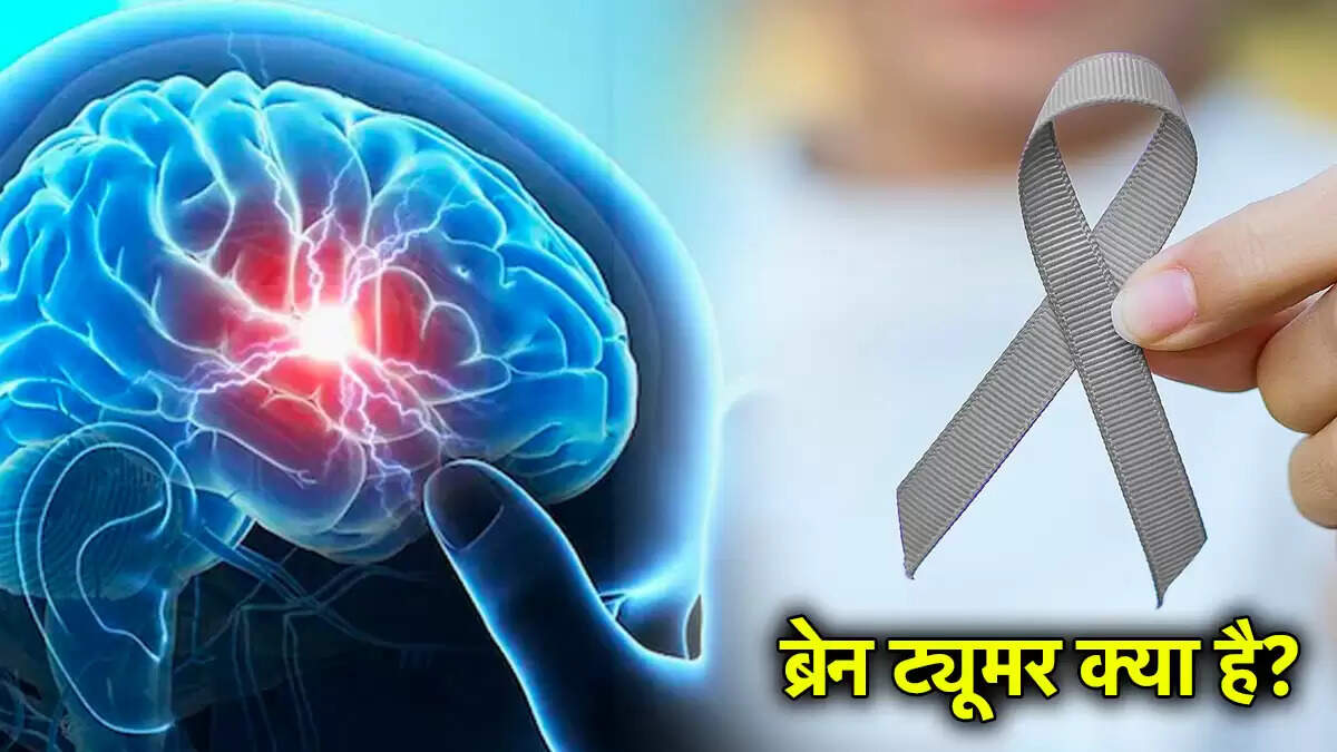 World Tumour Day: ब्रेन ट्यूमर के लक्षण और पहचान के तरीके