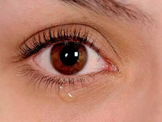 आंखों से पानी गिरने की समस्या का घरेलू उपचार