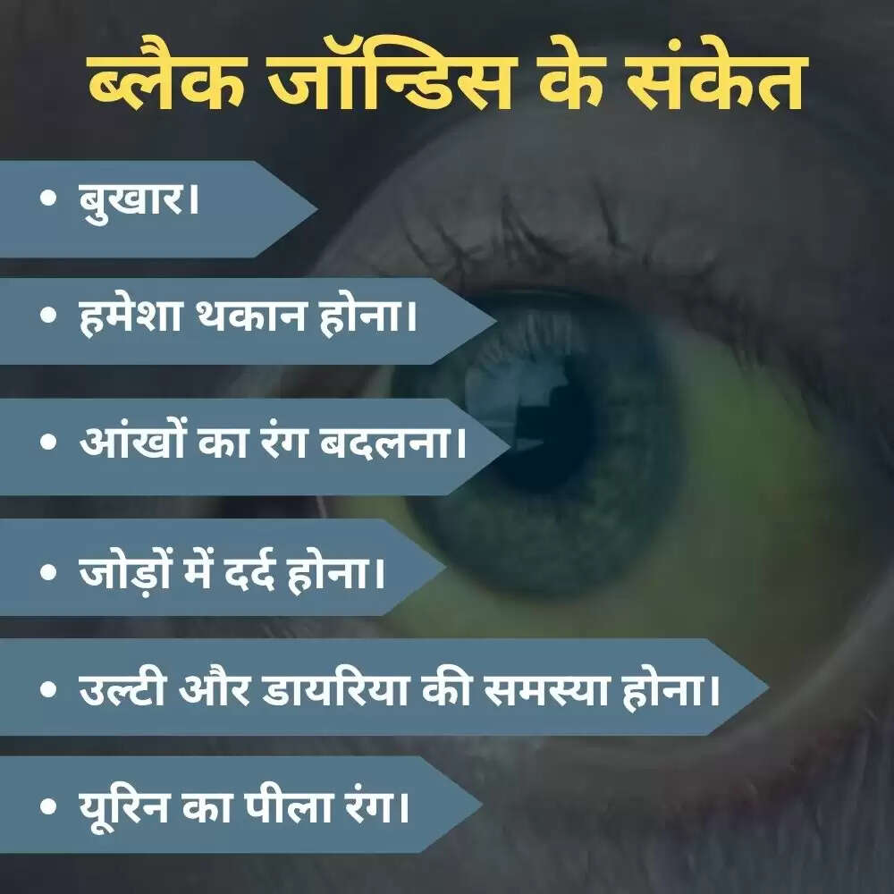 काले पीलिया पर नई रिसर्च: रोहतक पीजीआई में 12 साल का अध्ययन