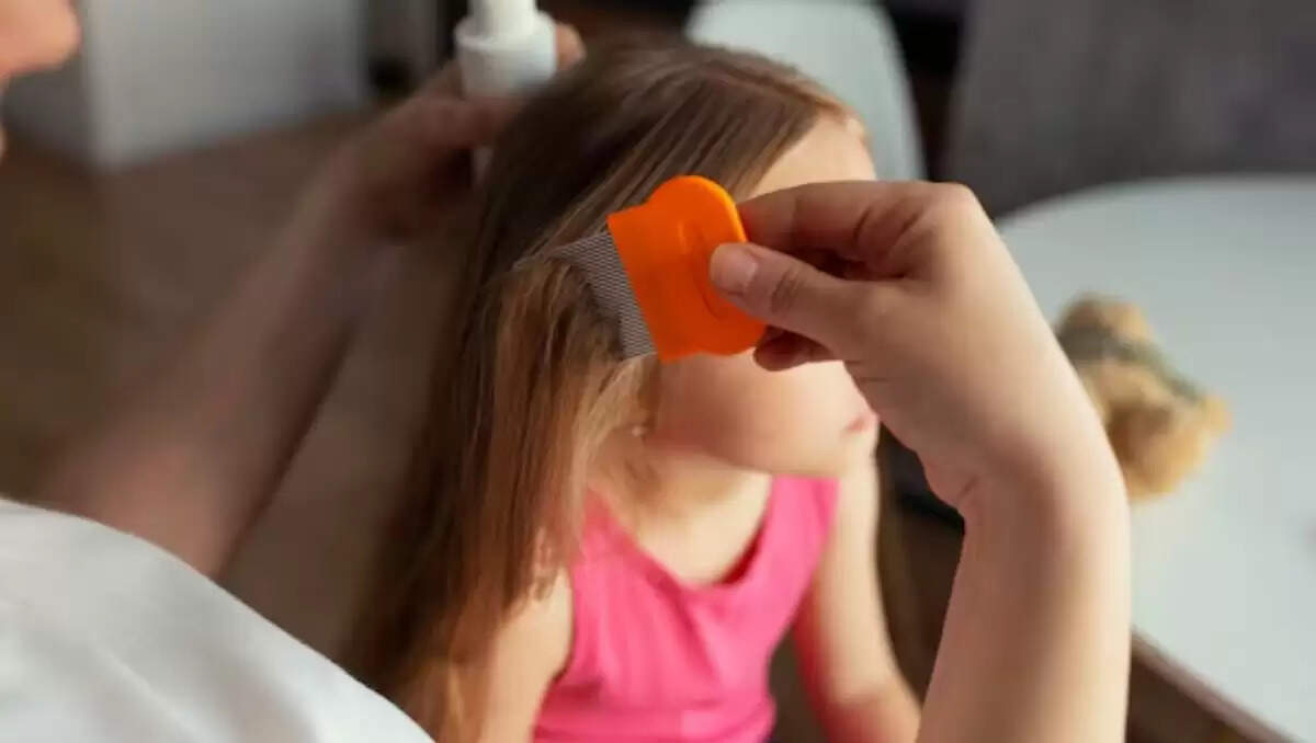 मानसून में बालों की देखभाल: जुओं से छुटकारा पाने के आसान उपाय