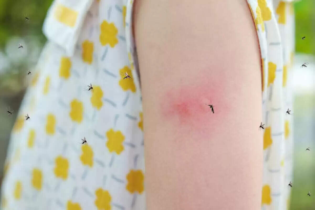 बच्चों को मच्छरों से सुरक्षित रखने के प्राकृतिक उपाय